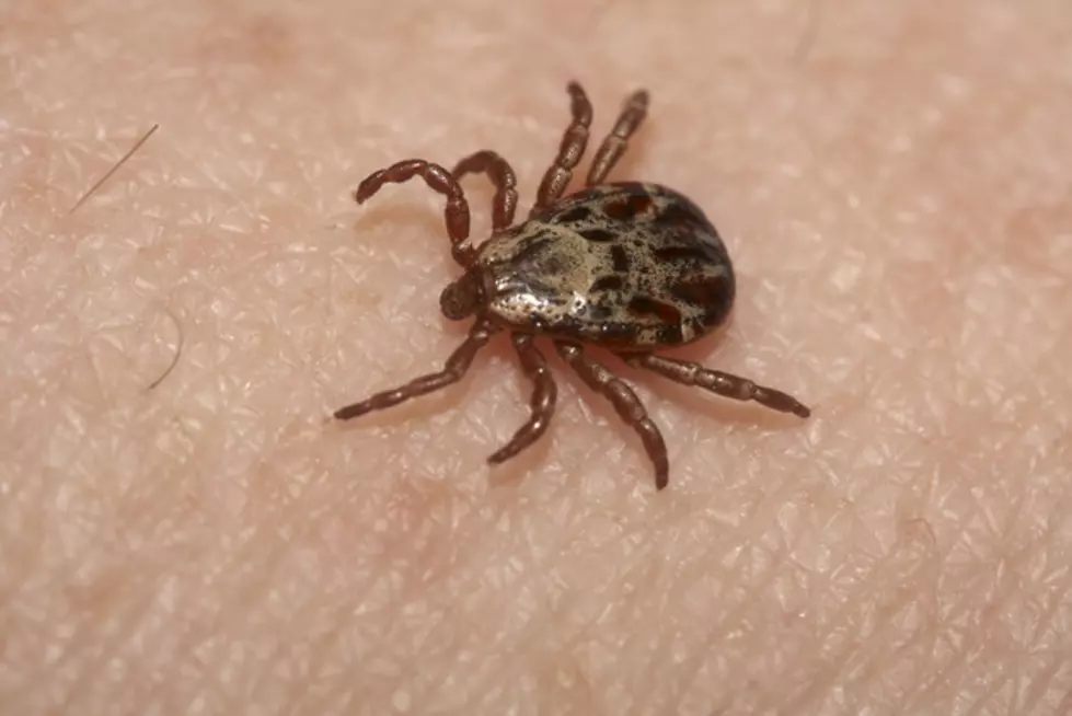 Tick advice you need to know heading into the summer